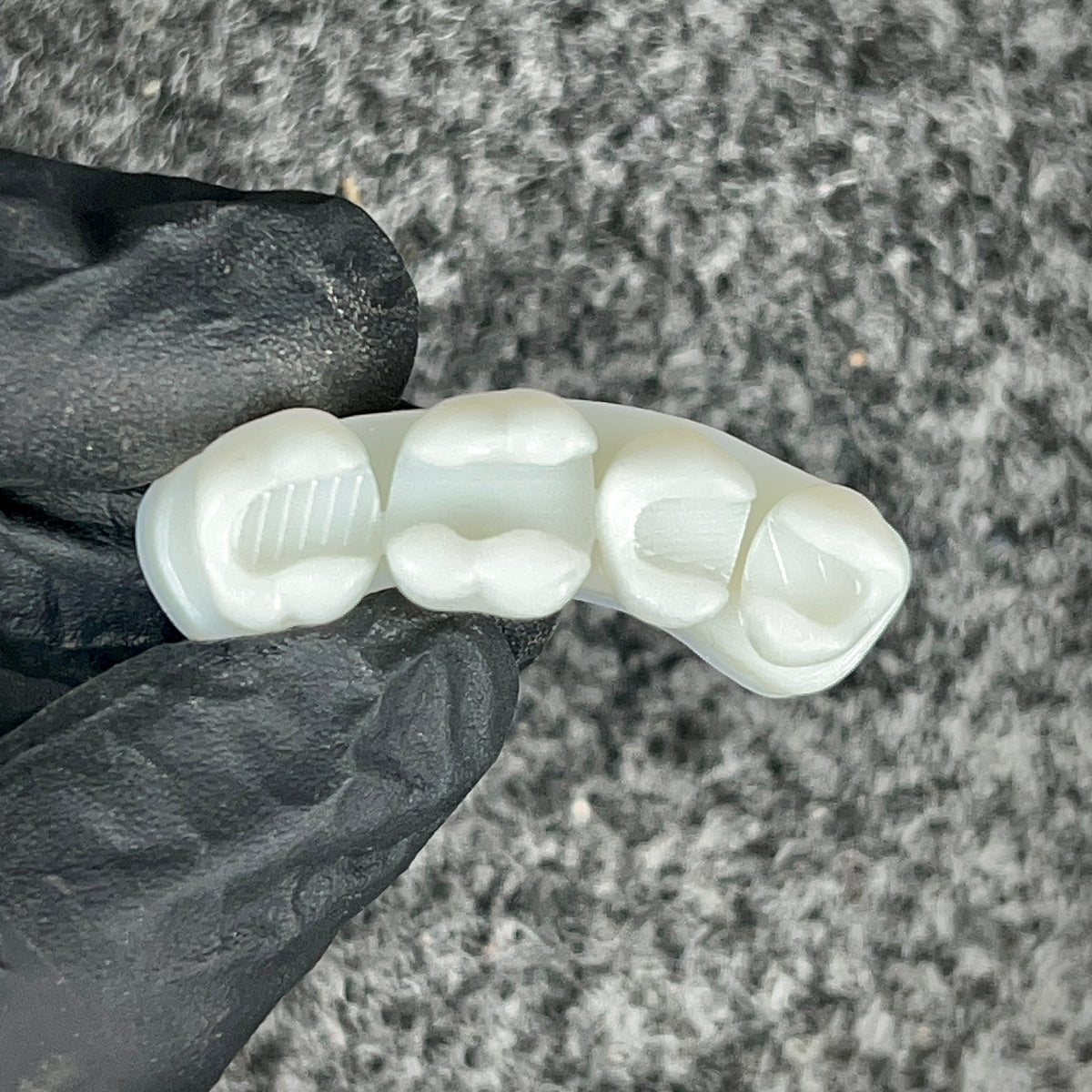 Dental Training Casts