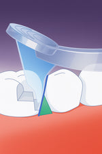 Proximal contact tool