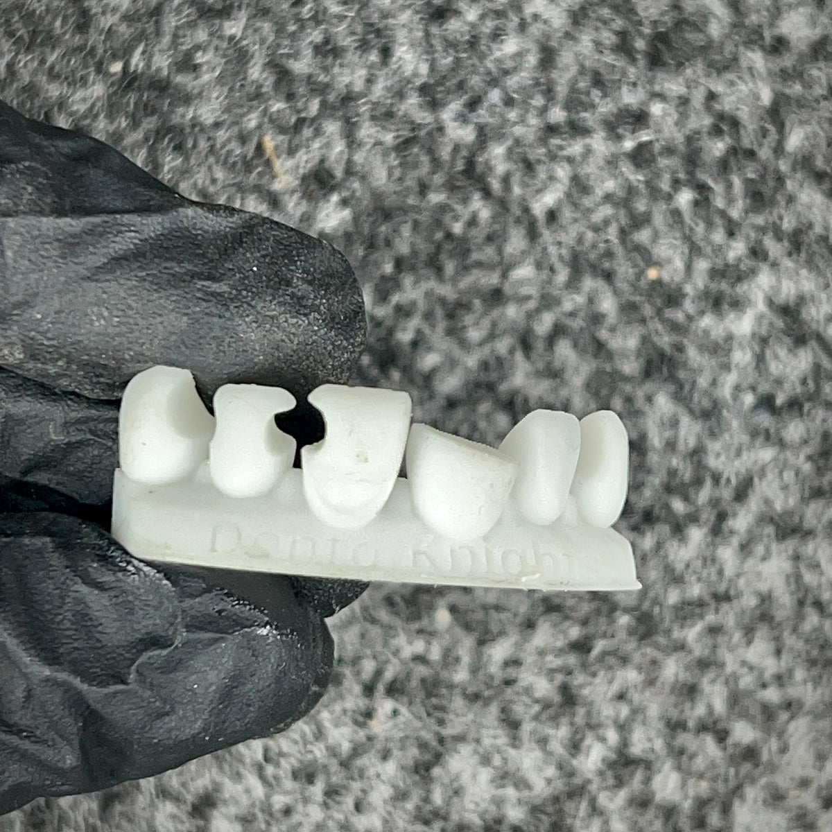 Dental Training Casts